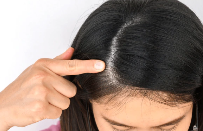 Beyond Hair Loss: The Role of Wigs in Healing and Self-Expression