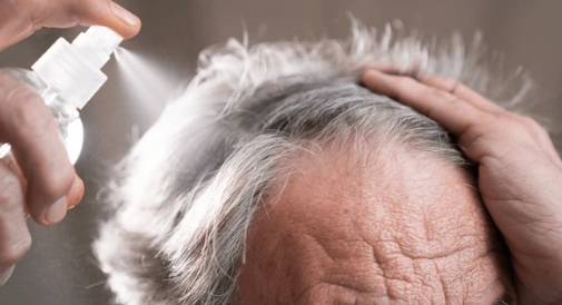 Understanding Hair Loss in the Elderly And How Wigs Can Help Bring Back Confidence