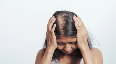 Hidden Causes of Hair Loss: The Nutritional Deficiencies You Might Be Overlooking (and How Wigs Can Help You Shine Again)