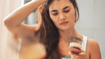 Tinea Capitis and Hair Loss: Understanding the Condition and Exploring Wig Options